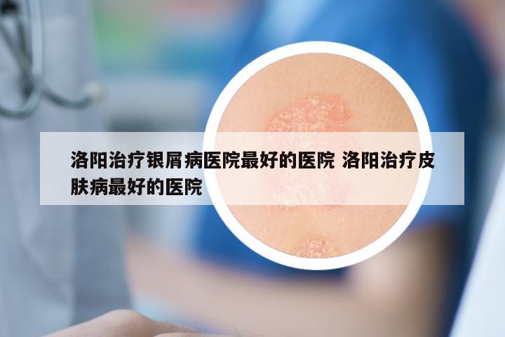 洛阳治疗银屑病医院最好的医院 洛阳治疗皮肤病最好的医院