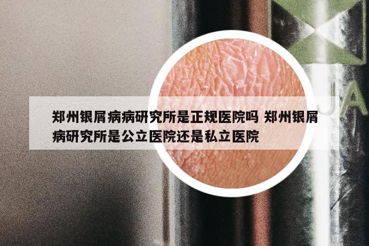 郑州银屑病病研究所是正规医院吗 郑州银屑病研究所是公立医院还是私立医院
