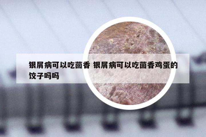 银屑病可以吃茴香 银屑病可以吃茴香鸡蛋的饺子吗吗