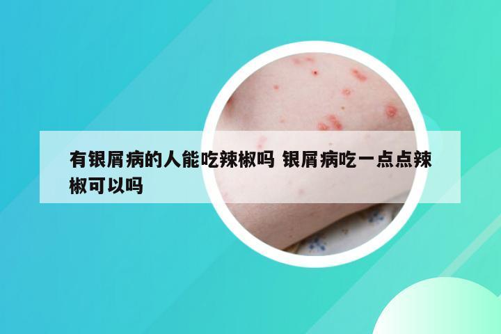 有银屑病的人能吃辣椒吗 银屑病吃一点点辣椒可以吗