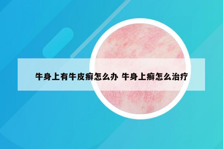 牛身上有牛皮癣怎么办 牛身上癣怎么治疗