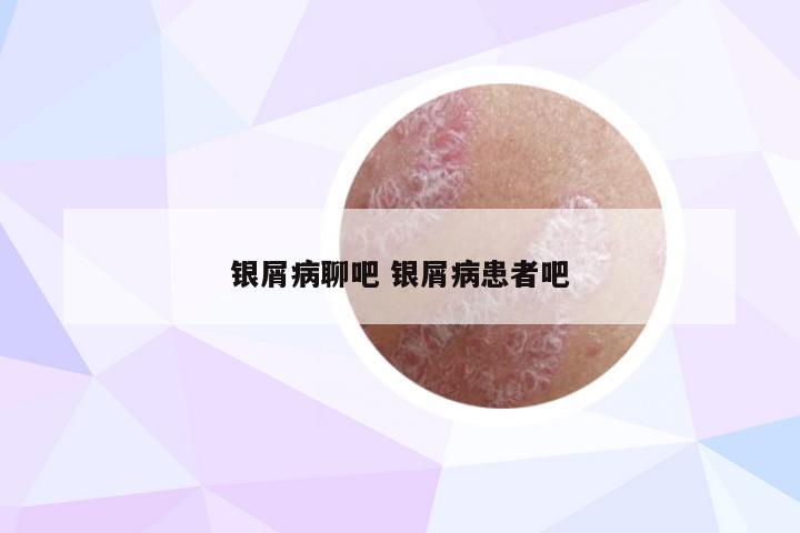 银屑病聊吧 银屑病患者吧