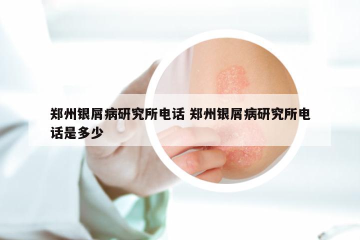 郑州银屑病研究所电话 郑州银屑病研究所电话是多少