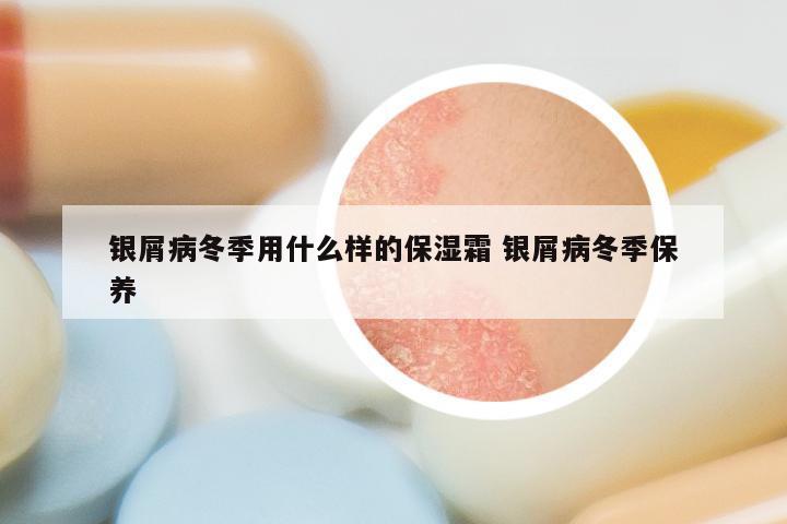 银屑病冬季用什么样的保湿霜 银屑病冬季保养