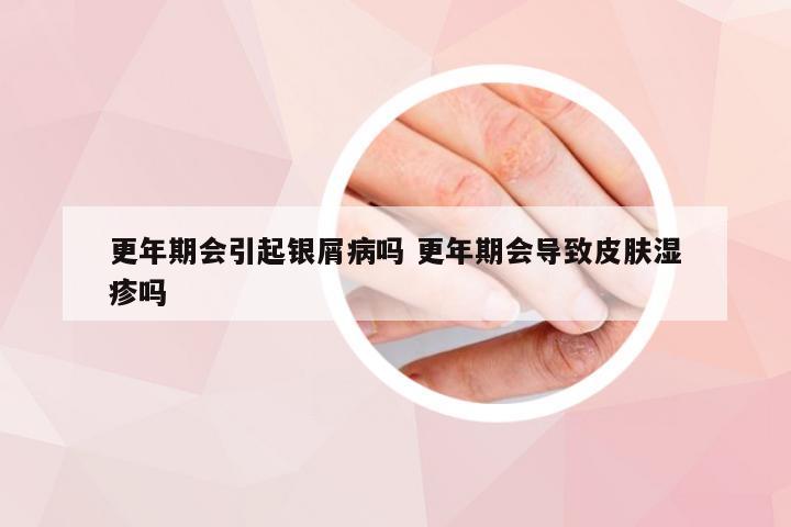 更年期会引起银屑病吗 更年期会导致皮肤湿疹吗
