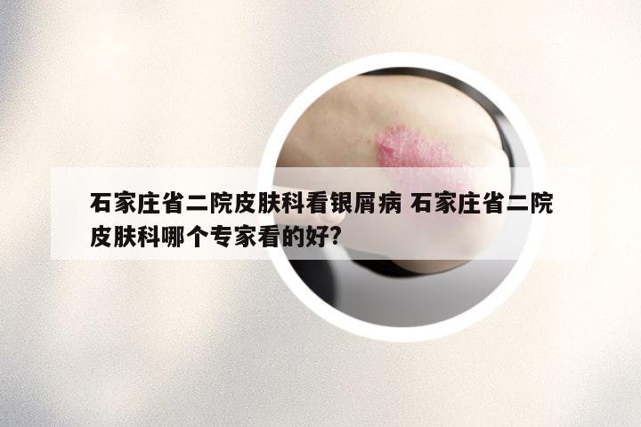石家庄省二院皮肤科看银屑病 石家庄省二院皮肤科哪个专家看的好?