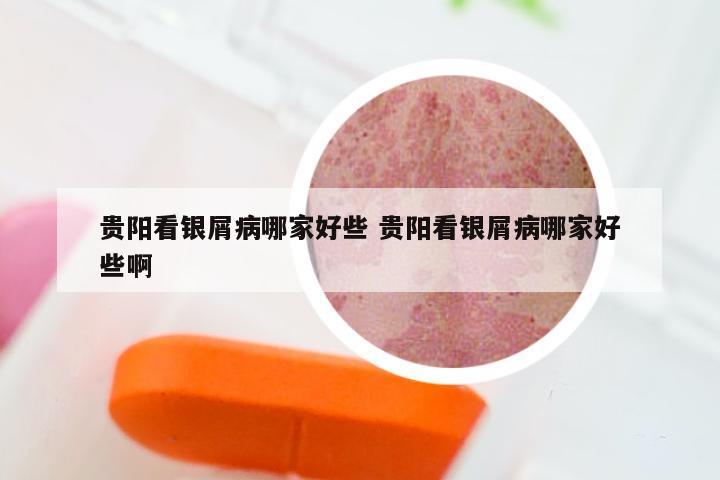贵阳看银屑病哪家好些 贵阳看银屑病哪家好些啊