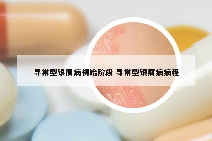 寻常型银屑病初始阶段 寻常型银屑病病程