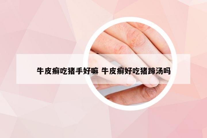 牛皮癣吃猪手好嘛 牛皮癣好吃猪蹄汤吗