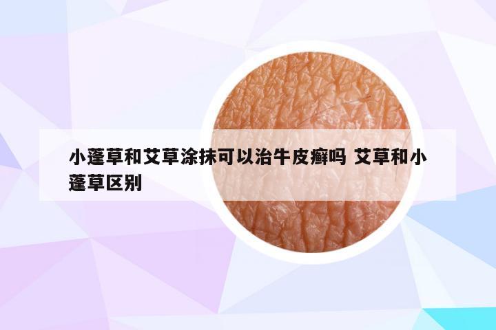 小蓬草和艾草涂抹可以治牛皮癣吗 艾草和小蓬草区别