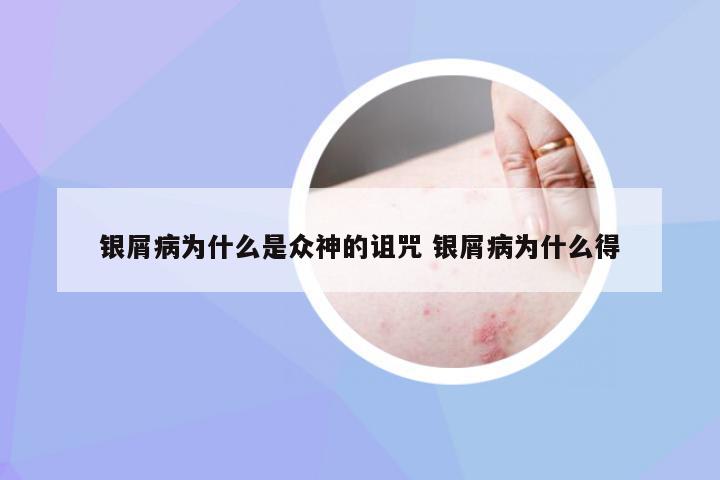 银屑病为什么是众神的诅咒 银屑病为什么得