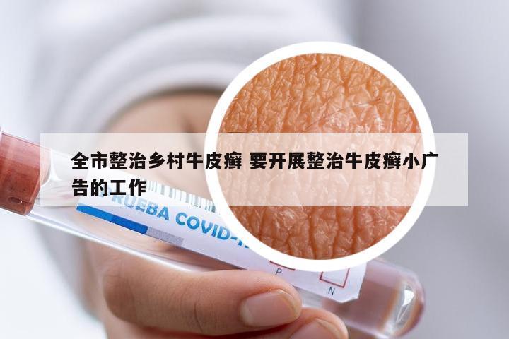 全市整治乡村牛皮癣 要开展整治牛皮癣小广告的工作