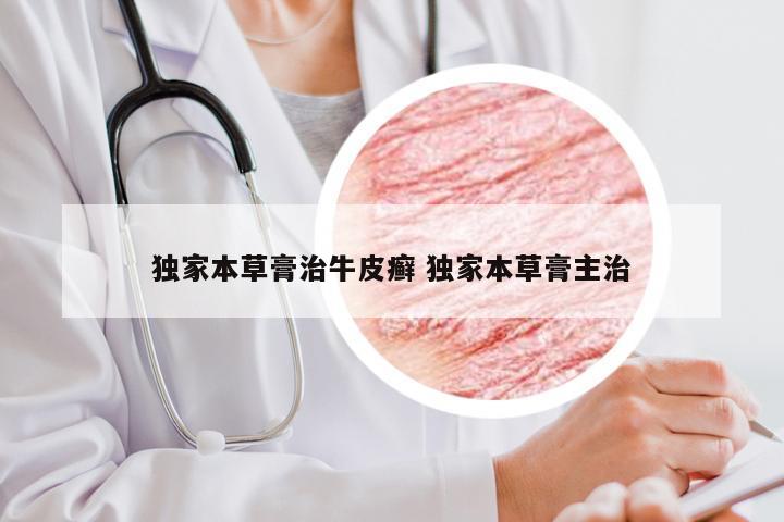 独家本草膏治牛皮癣 独家本草膏主治