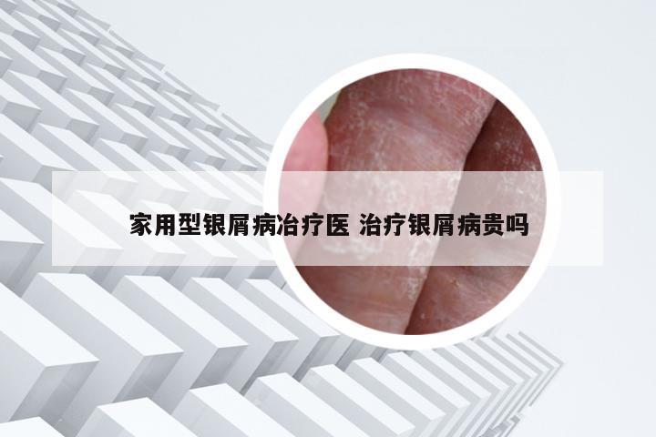 家用型银屑病冶疗医 治疗银屑病贵吗