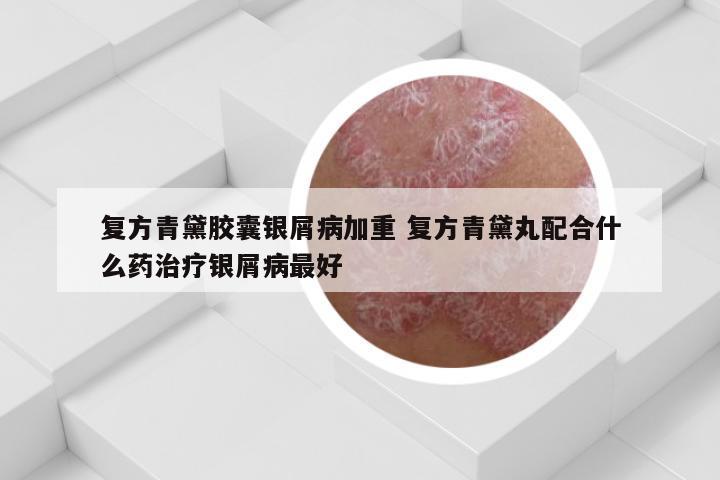 复方青黛胶囊银屑病加重 复方青黛丸配合什么药治疗银屑病最好