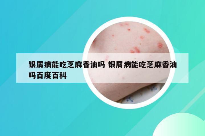 银屑病能吃芝麻香油吗 银屑病能吃芝麻香油吗百度百科
