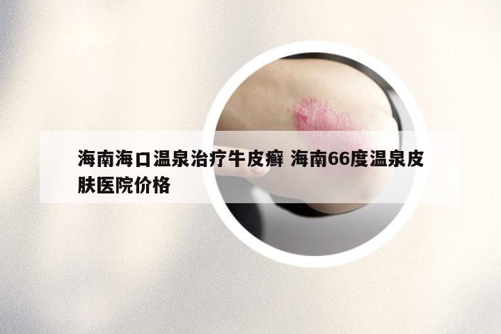 海南海口温泉治疗牛皮癣 海南66度温泉皮肤医院价格