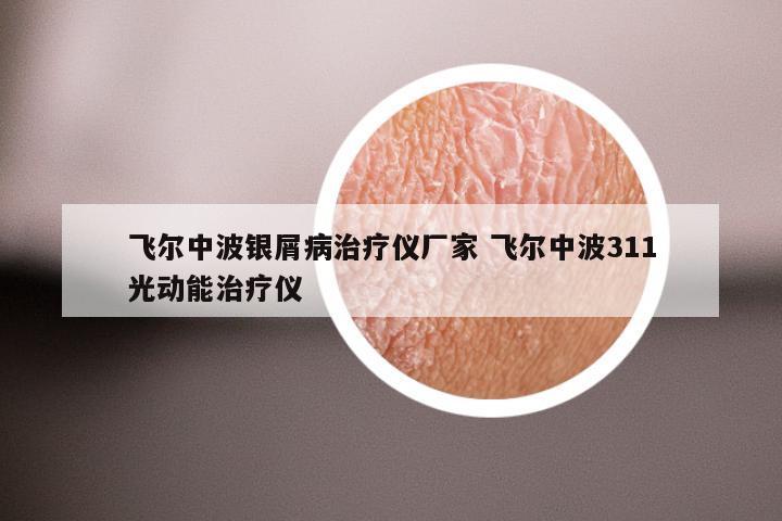 飞尔中波银屑病治疗仪厂家 飞尔中波311光动能治疗仪