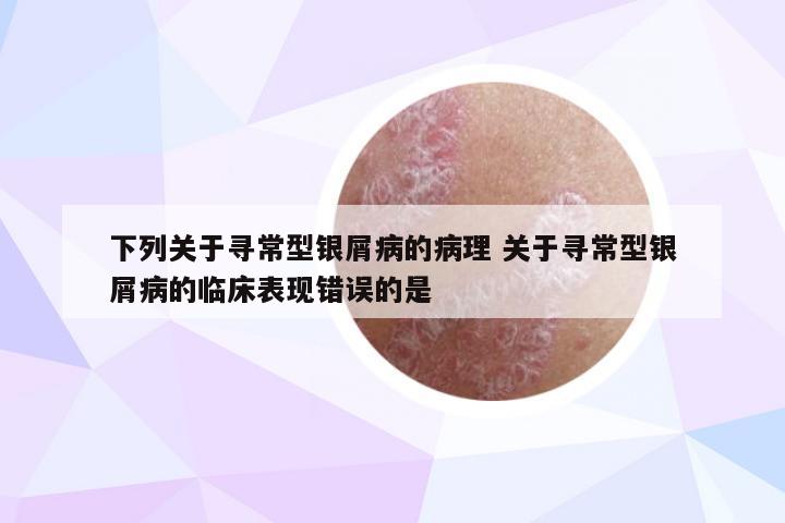 下列关于寻常型银屑病的病理 关于寻常型银屑病的临床表现错误的是