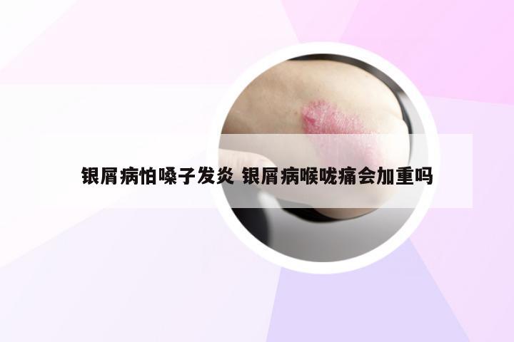 银屑病怕嗓子发炎 银屑病喉咙痛会加重吗