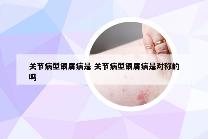 关节病型银屑病是 关节病型银屑病是对称的吗
