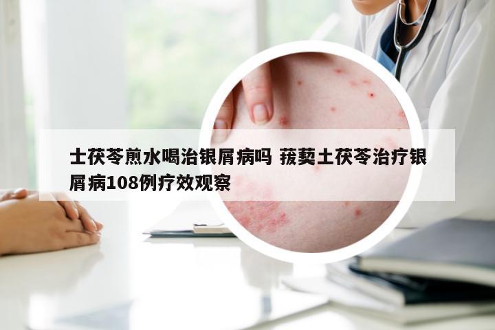 士茯苓煎水喝治银屑病吗 菝葜土茯苓治疗银屑病108例疗效观察