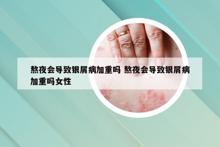 熬夜会导致银屑病加重吗 熬夜会导致银屑病加重吗女性