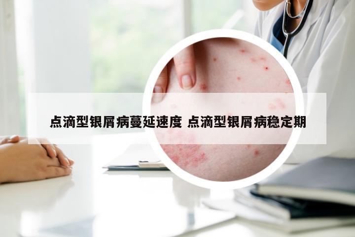 点滴型银屑病蔓延速度 点滴型银屑病稳定期
