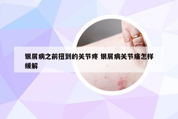 银屑病之前扭到的关节疼 银屑病关节痛怎样缓解