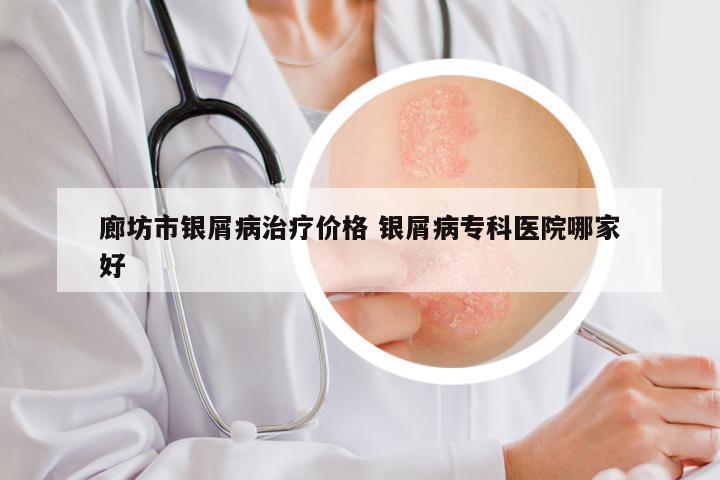 廊坊市银屑病治疗价格 银屑病专科医院哪家好