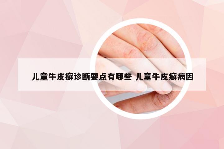 儿童牛皮癣诊断要点有哪些 儿童牛皮癣病因