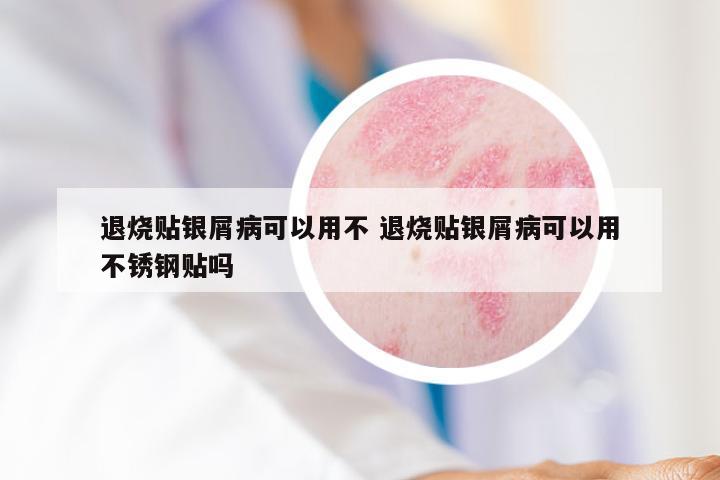退烧贴银屑病可以用不 退烧贴银屑病可以用不锈钢贴吗