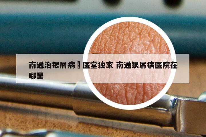 南通治银屑病崋医堂独家 南通银屑病医院在哪里