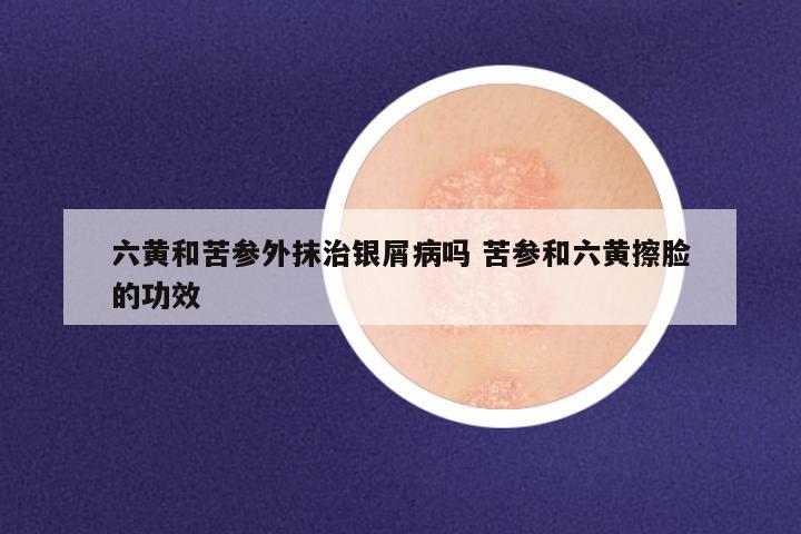 六黄和苦参外抹治银屑病吗 苦参和六黄擦脸的功效