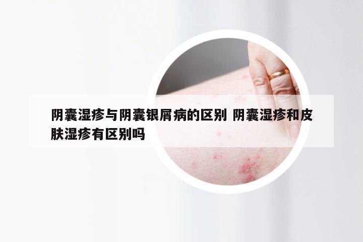 阴囊湿疹与阴囊银屑病的区别 阴囊湿疹和皮肤湿疹有区别吗
