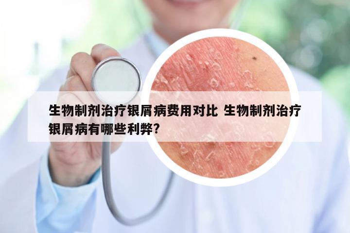 生物制剂治疗银屑病费用对比 生物制剂治疗银屑病有哪些利弊?