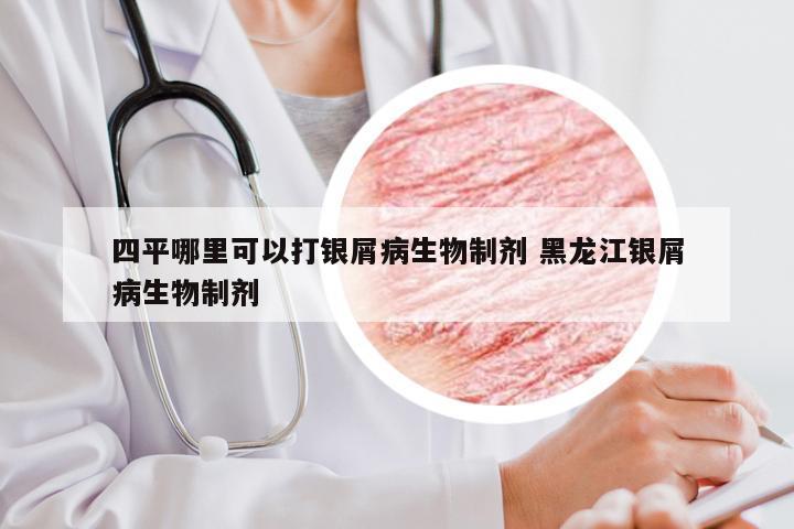 四平哪里可以打银屑病生物制剂 黑龙江银屑病生物制剂