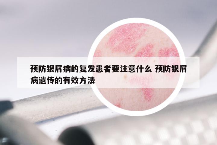 预防银屑病的复发患者要注意什么 预防银屑病遗传的有效方法