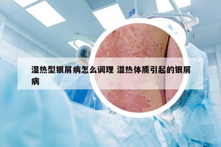 湿热型银屑病怎么调理 湿热体质引起的银屑病