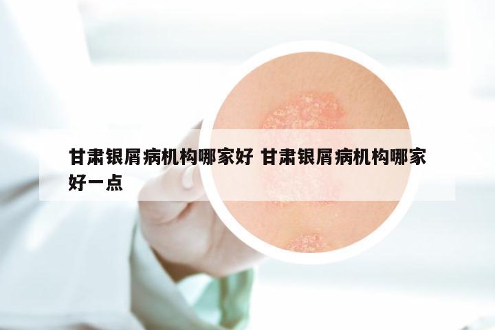 甘肃银屑病机构哪家好 甘肃银屑病机构哪家好一点