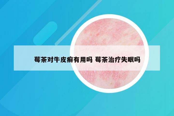 莓茶对牛皮癣有用吗 莓茶治疗失眠吗