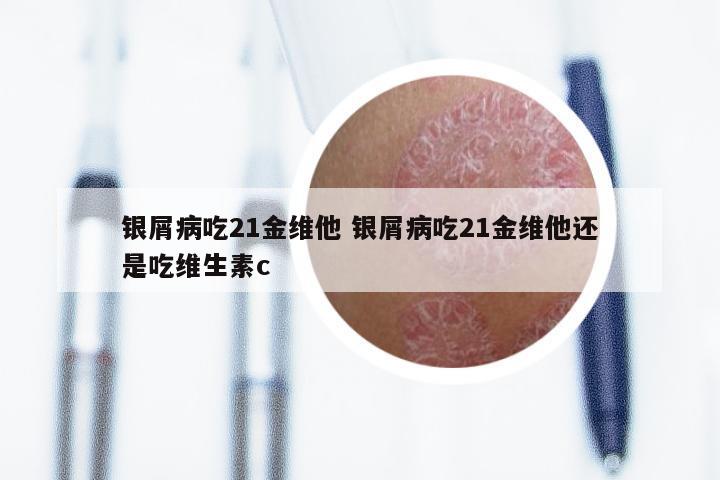 银屑病吃21金维他 银屑病吃21金维他还是吃维生素c