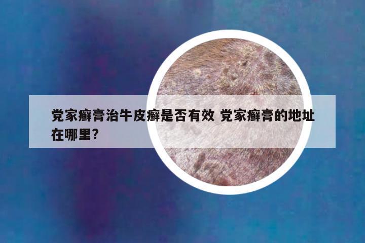 党家癣膏治牛皮癣是否有效 党家癣膏的地址在哪里?