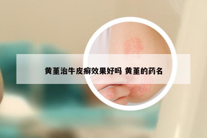 黄堇治牛皮癣效果好吗 黄堇的药名