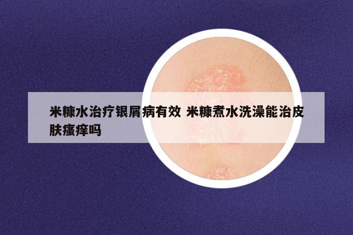 米糠水治疗银屑病有效 米糠煮水洗澡能治皮肤瘙痒吗