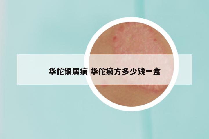 华佗银屑病 华佗癣方多少钱一盒