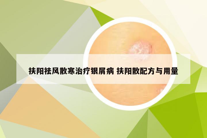 扶阳祛风散寒治疗银屑病 扶阳散配方与用量