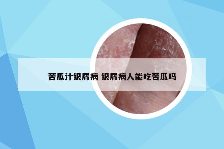 苦瓜汁银屑病 银屑病人能吃苦瓜吗