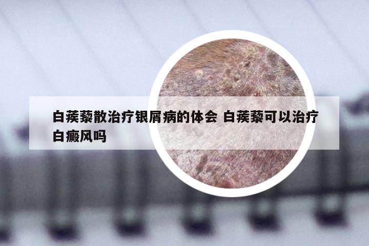 白蒺藜散治疗银屑病的体会 白蒺藜可以治疗白癜风吗