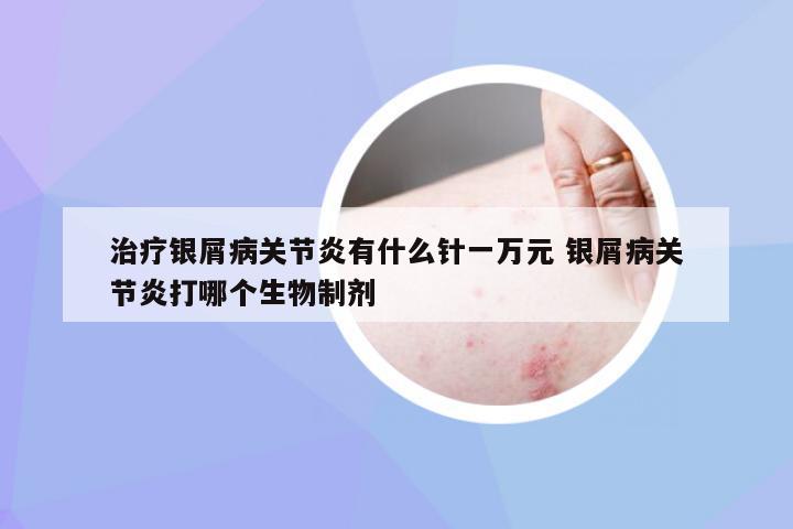 治疗银屑病关节炎有什么针一万元 银屑病关节炎打哪个生物制剂